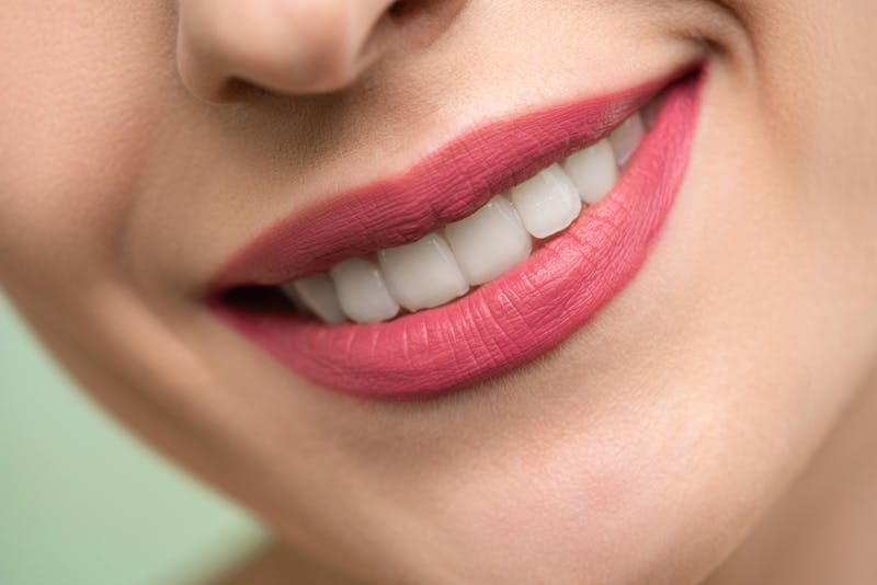 After whitening